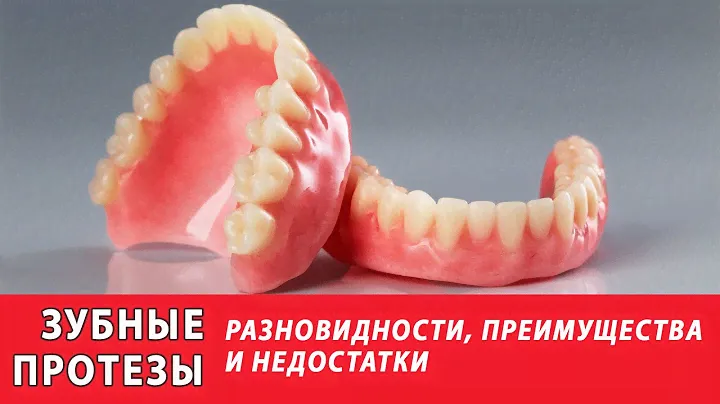 Какие бывают частичные съёмные протезы зубов?